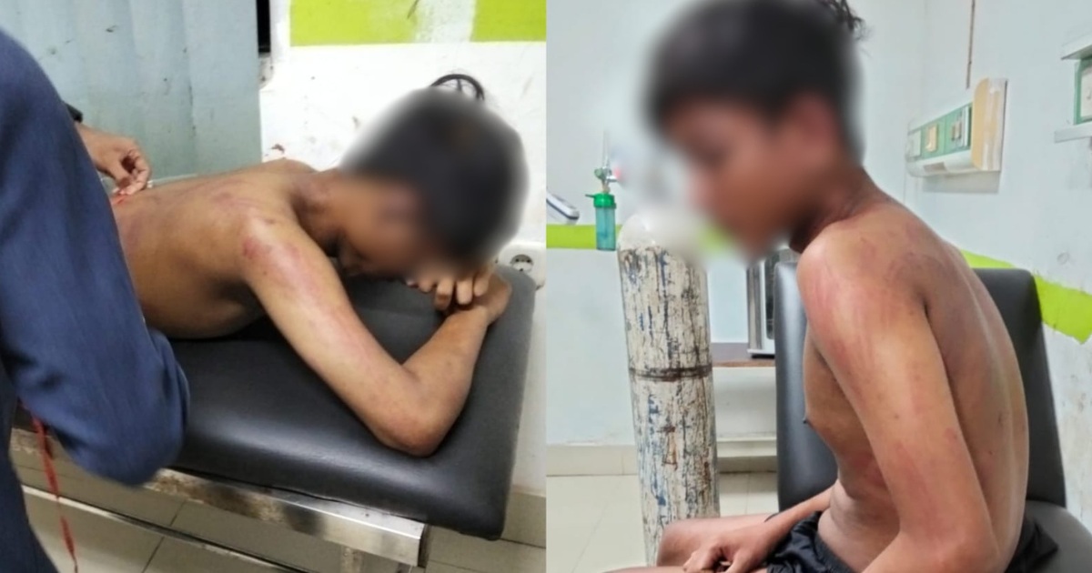 Remaja korban dugaan penganiayaan di Muna menjalani pemeriksaan medis dengan wajah disamarkan.